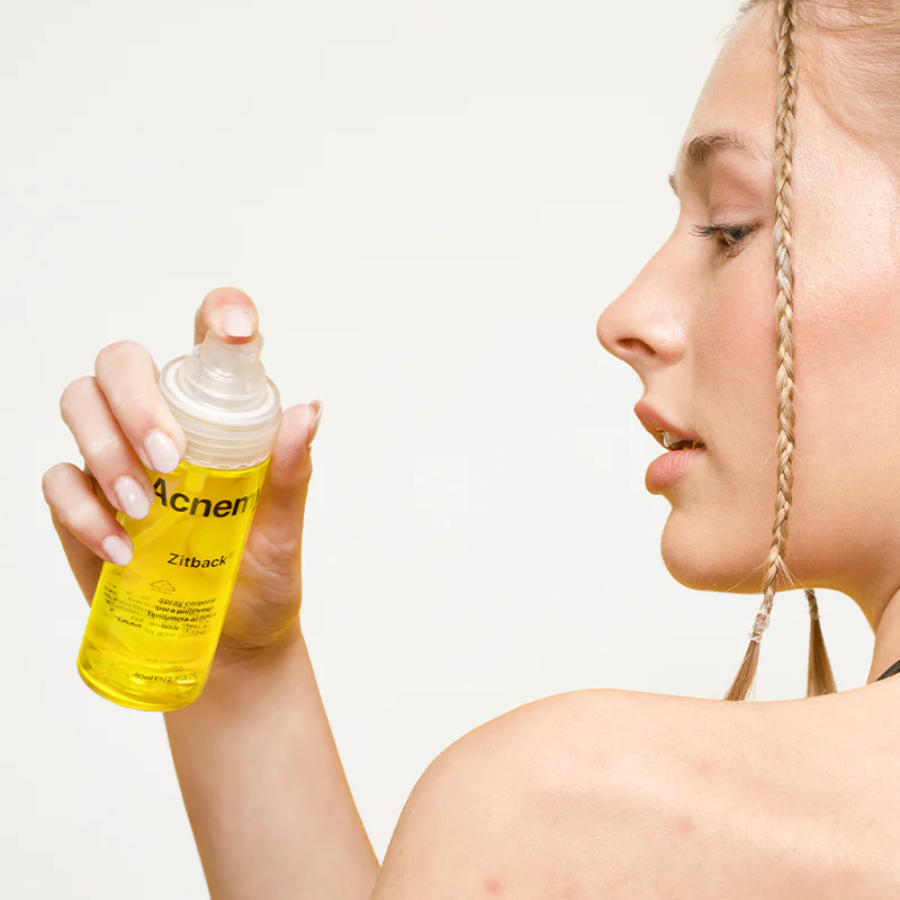 Acnemy Zitback Body Spray 80ml