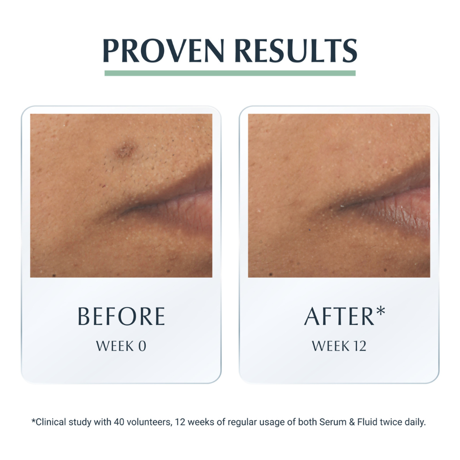 Eucerin Dermopure Sérum Triplo Efeito 40ml