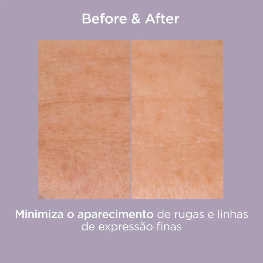 Isdin Isdinceutics Renew Glicoisdin 25 Intense Gel 50g