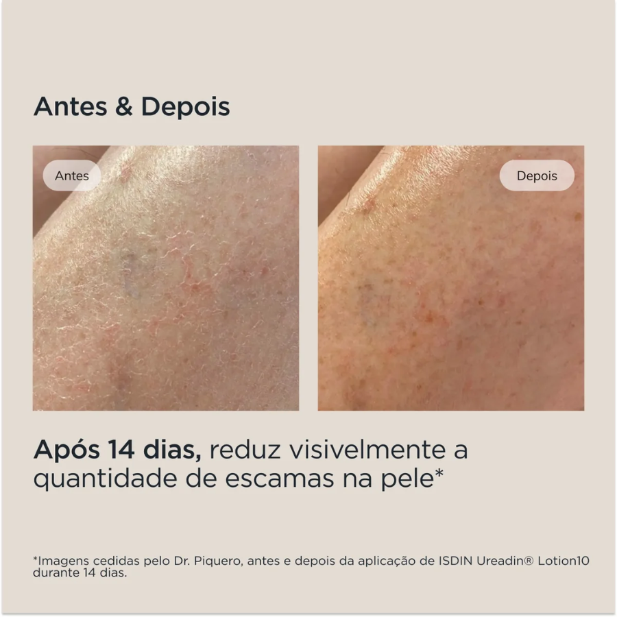 Isdin Hydration Ureadin Lotion 10 Hidratação Intensiva 1L